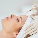 Things to Do Before Botox: A Simple Guide for Your Best Results