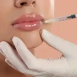 botox-vs-fillers