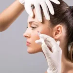 is-xeomin-better-than-botox