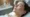 microneedling-work