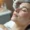 microneedling-work